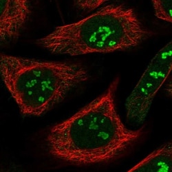 SRFBP1 Antibody, Novus Biologicals 0.1mL; Unlabeled:Antibodies, Polyclonal